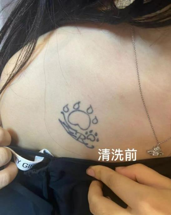 焱腾科技·洗纹身超皮秒·修复疤痕增生(武昌火车站店)